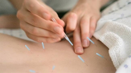 ACUPUNTURA